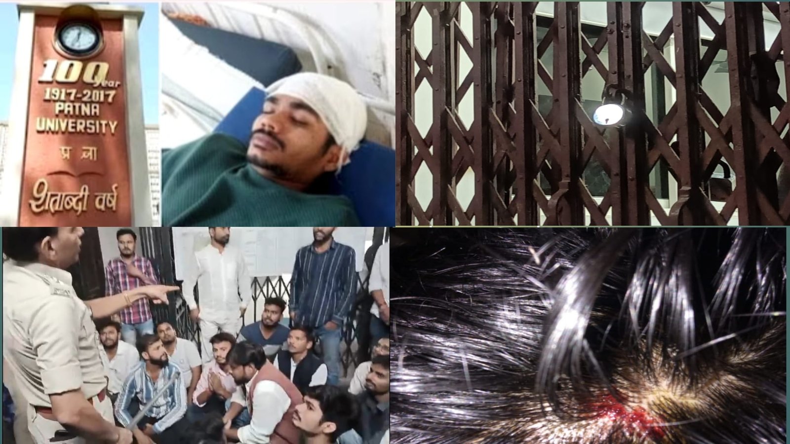 "पटना यूनिवर्सिटी में चुनाव की मांग को लेकर छात्र संघर्ष, पुलिस कार्रवाई में घायल।"